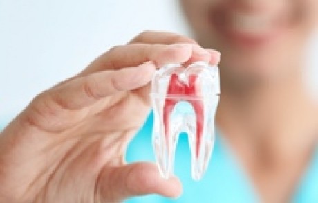 Root Canals