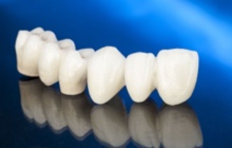 Zirconium Crowns