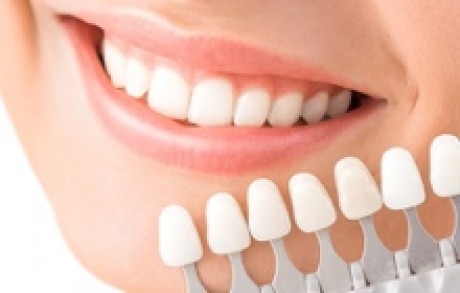 Porcelain Crowns